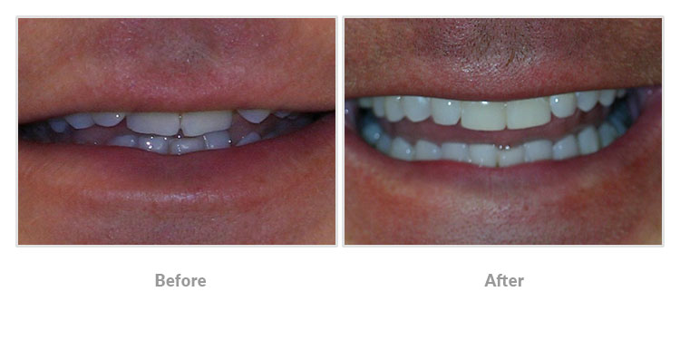 orthodontics patient